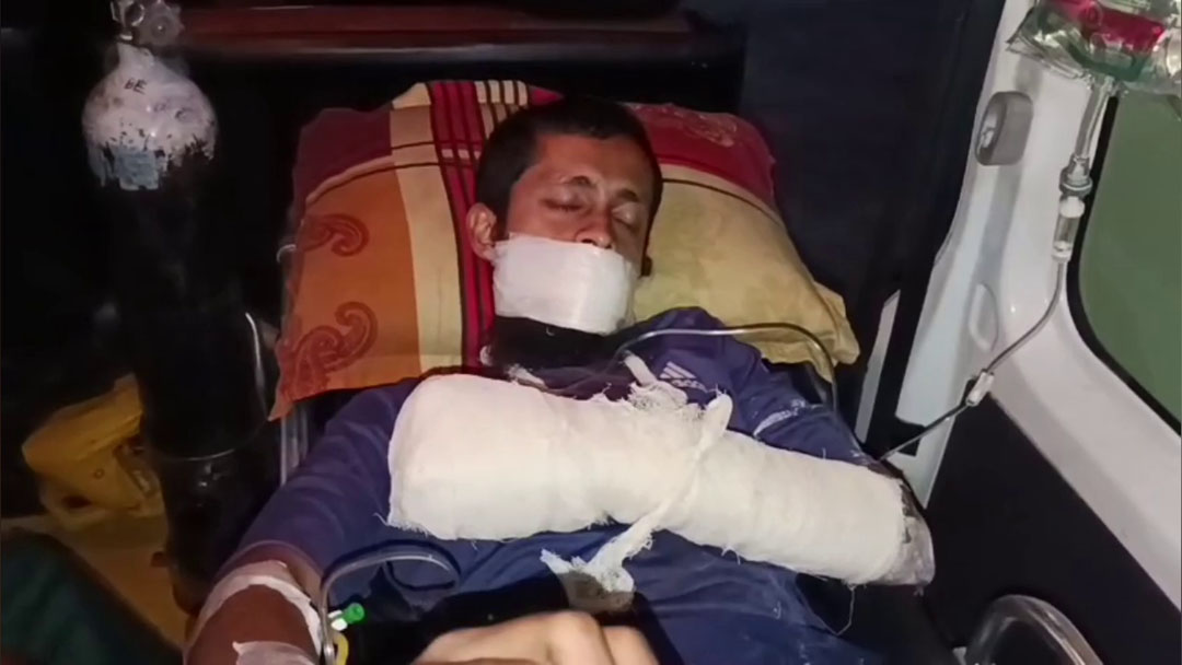 টুঙ্গিপাড়ায় হাতবোমা বানাতে গিয়ে যুবক মারাত্মক আহত। পুলিশ পাহারায় চিকিৎসা